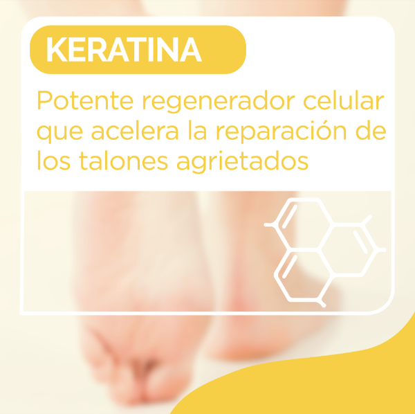 Creme Scholl para calcanhares gretados