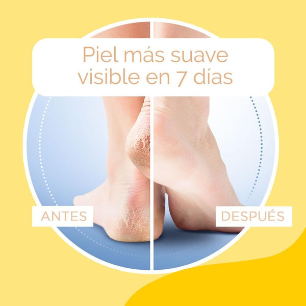 Scholl Crema de Durezas