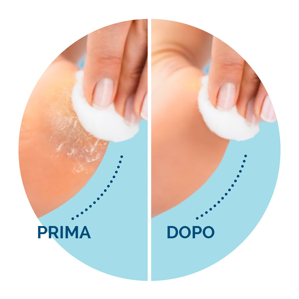 Velvet Roll per Pedicure con Spazzole Extraesfolianti