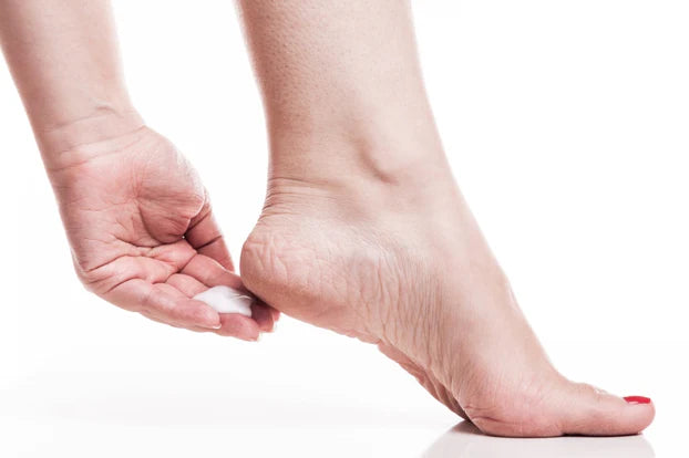 Cracked Heels 101: Causes, Symptoms and Treatment