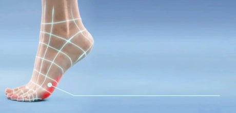 Ball of foot pain
