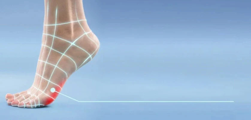 Ball of foot pain
