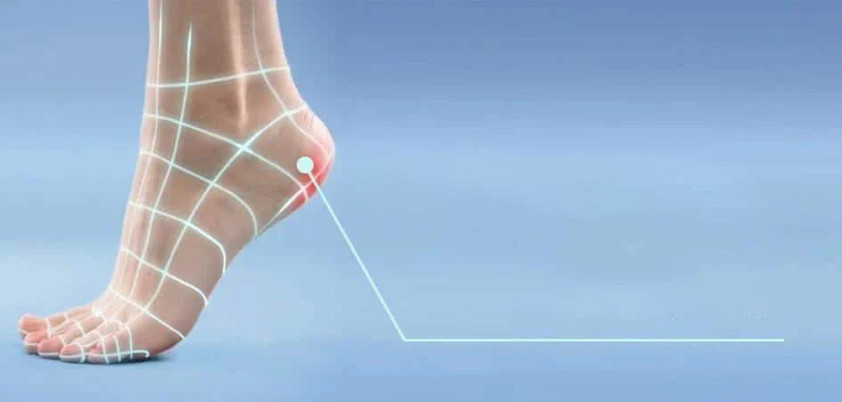 Heavy Legs: treatments and Causes