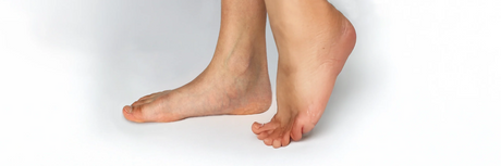 Flat Feet