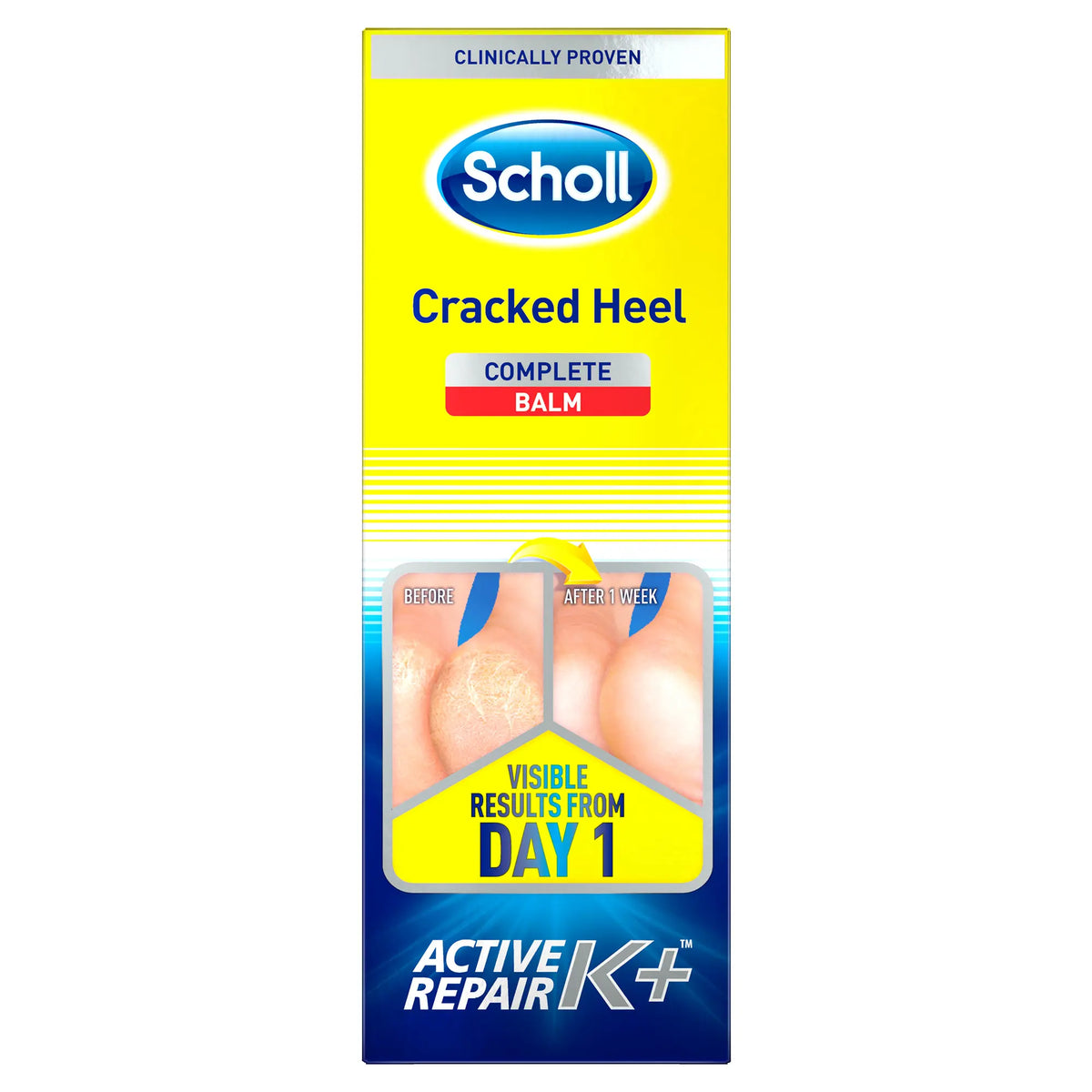 Scholl Aid Cracked Heel Repair Balm: Active Repair K+