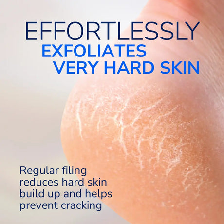 Callus Remover Electric Foot File