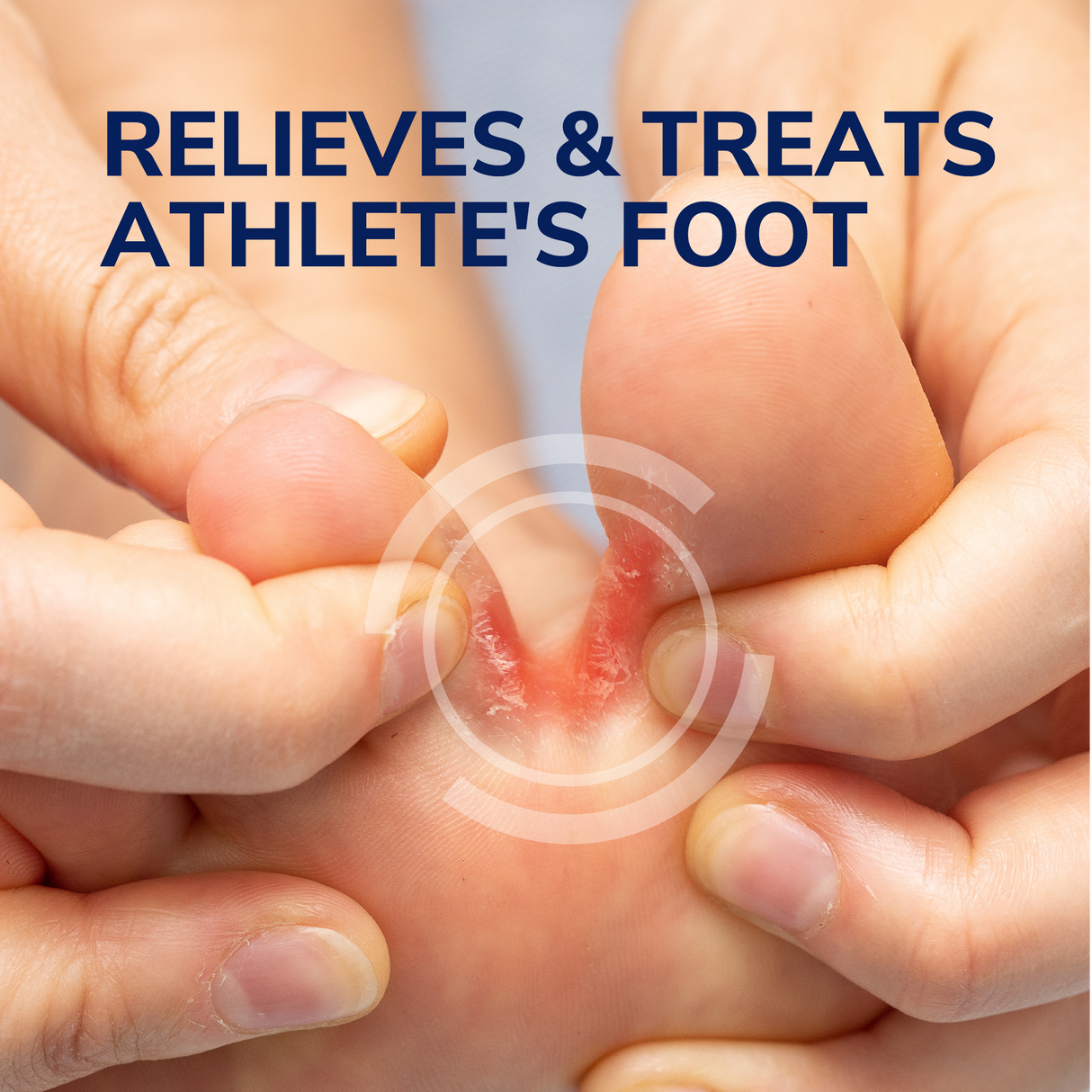 Athlete's Foot Treatment 4-in-1 Gel