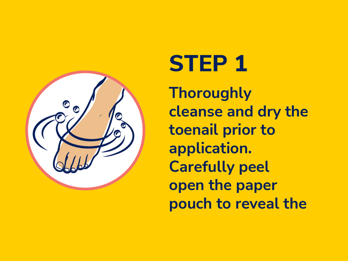 Ingrown Toenail 12-Hour Pain Relief Strips