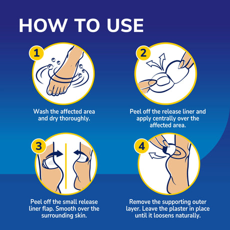 Extreme Blister Plasters for Feet with Aloe Vera