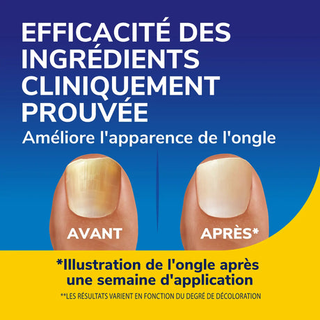 Dr Scholl’s Sérum revitalisant ongles jaunis, décolorés ou abimés 10ml