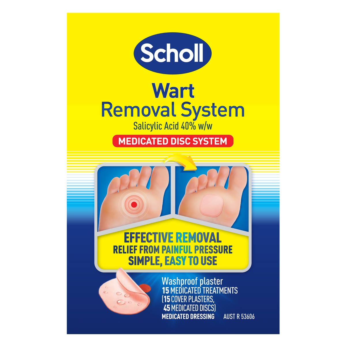 Scholl-systeem voor het verwijderen van wratten