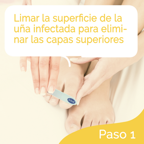 Scholl Tratamiento Anti-Hongos para uñas