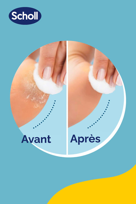 Scholl vervangingsrollen 2-in-1 exfoliërend en gladmakend voor elektrische voetvijl